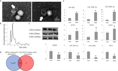 Metabolic Syndrome Is Associated With Altered mRNA and miRNA Content in Human Circulating Extracellular Vesicles